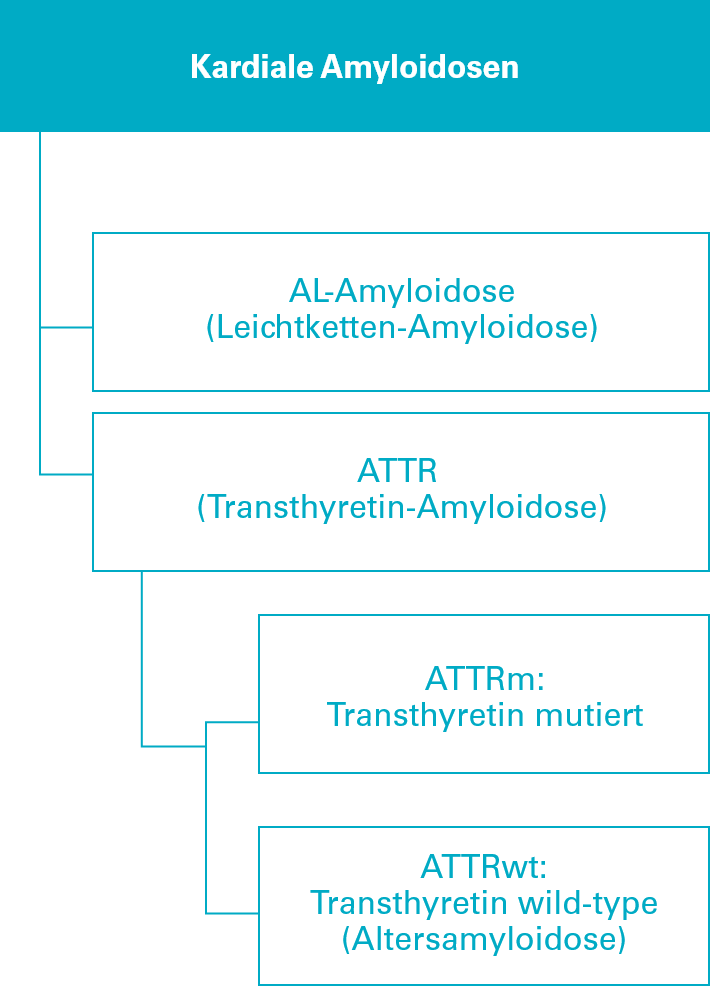 Übersicht zur Klassifizierung der häufigsten kardialen Amyloidosen - mobile Ansicht