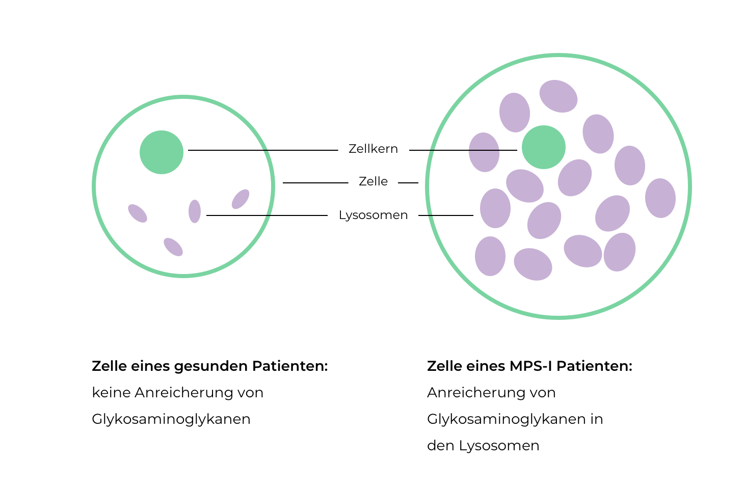 Glykosaminoglykane_Lysosome_Mukopolysaccharidose_lysosomale Speicherkrankheit_MPS I_GAG